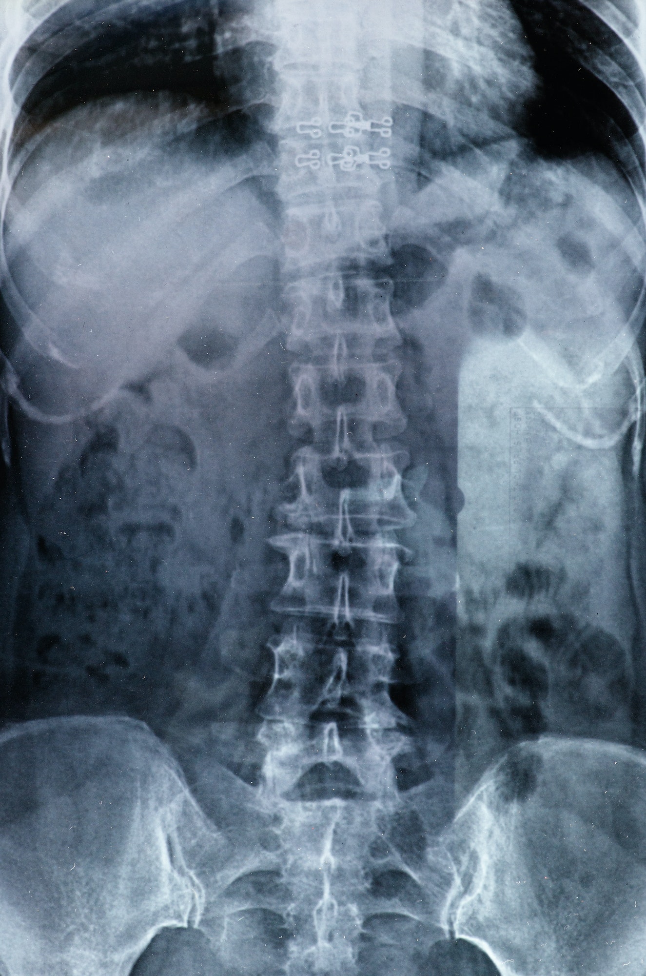 x-rays